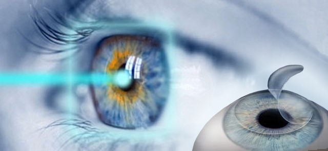 7 неприятностей после лазерной коррекции зрения