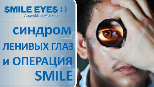 Можно ли делать операцию SMILE при синдроме «ленивых глаз»?